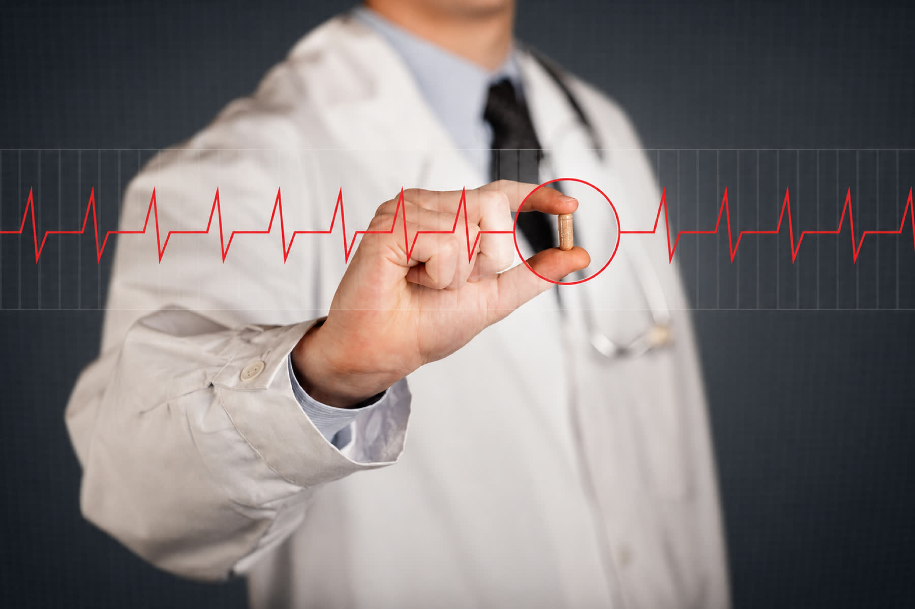 Arrhythmia