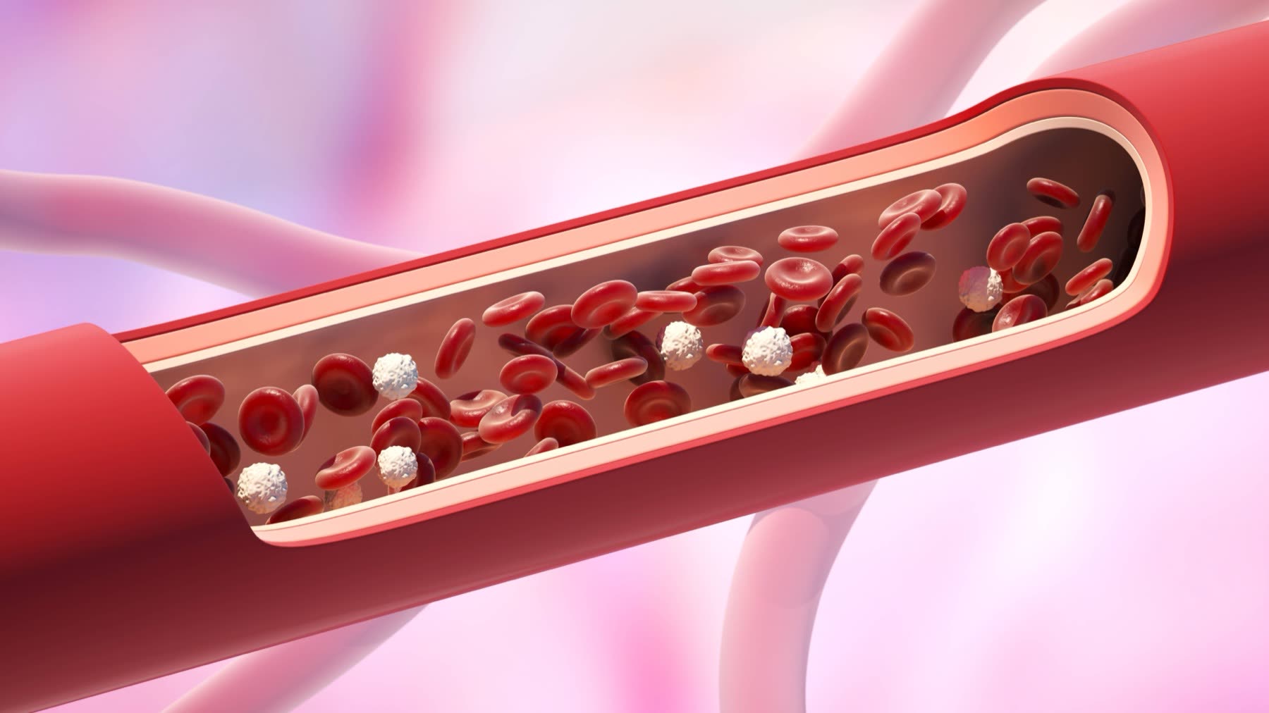 Coronary Artery Disease